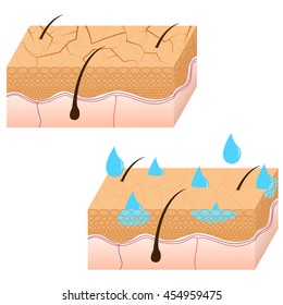 Skin Hydration Sectional View.