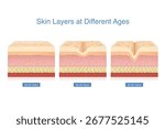 Skin layer changes and wrinkle development over three age stages. Illustration about fine lines and deep wrinkle on facial from loss collagen in different age.