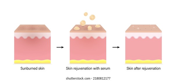 Capas de piel antes, durante y después del rejuvenecimiento con suero cutáneo. Vitaminas para el cuidado de la piel. Vector para publicidad sobre belleza y tratamiento médico.