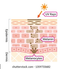 skin mechanism of melanin and facial dark spots. Infographic human skin layer illustration. Beauty and skin care concept