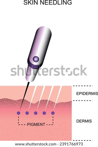 Skin needling. Skin layers. Microneedling guide.