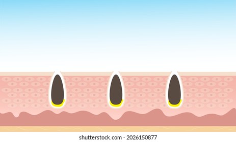 nutrición cutánea que protege la piel Shrink Pores Apriete los poros Acne tratamiento, apriete los poros, Acne ,limpieza de poros de piel