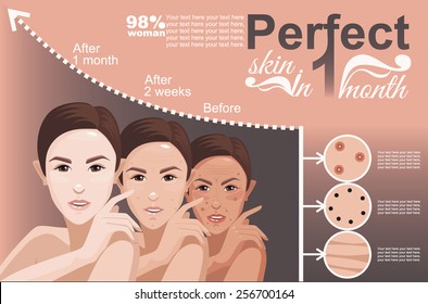 skin Oriental