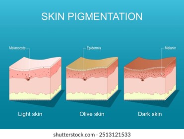 Pigmentação da pele. Seção transversal de uma epiderme humana com melanócitos e melanina. Gamas de cores da pele humana. Pele clara, oliva e escura em fundo azul. Cartaz detalhado do vetor. Isométrica