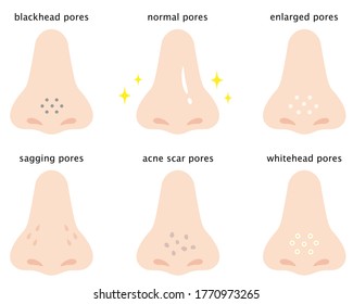 skin pores on human nose illustration. Isolated on white background. 