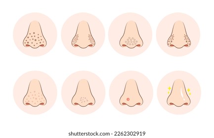 skin pores on human nose illustration. Isolated on white background.