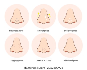 skin pores on human nose illustration. Isolated on white background.