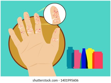 Skin problem concept with containers for medicine or acid or storage irritants