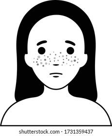 Skin Problem. Freckle. Minimal line art cartoon of girl with freckles on her face.