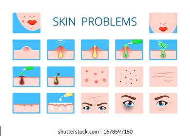 skin problem. hygiene infographic damaged skin dark circles face infection ages wrinkles clogged pores zits vector