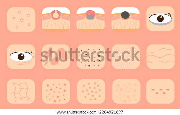 Skin Problem Illustration Set Vector Skin Stock Vector (Royalty Free ...