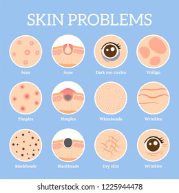 Skin problems. Ages wrinkles problem, face skin infection treatment and dark circles under eyes or black head pores, acne problems. Dermatology health vector icons set - Shutterstock ID 1225944478