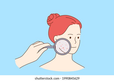 Skin problems and beauty concept. Face of young smiling pretty red haired woman cartoon character with magnifying glass and red pimples on skin vector illustration 