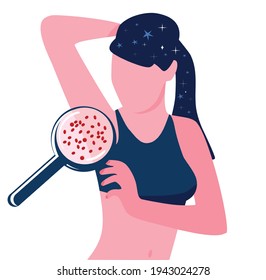 Skin problems because of Wrong shaving or depilation. Comedones and clogged pores. Ingrown hair. Strawberry armpit. Young woman in sportswear.Magnifier zooms inflammation.Vector illustration