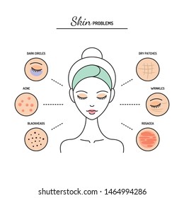 Skin problems chart, dark circles, acne, blackheads, dryness, wrinkles, rosacea. Line vector illustration, design template.