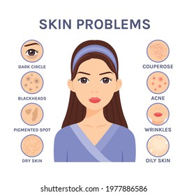 Skin problems close-up. Beautiful Brunette Woman and facial Diseases: Acne, Blackheads, Dry, Oily, Wrinkles, Dark circles, Couperose, Pigmented spot, Flat color cartoon style. White background.Vector.