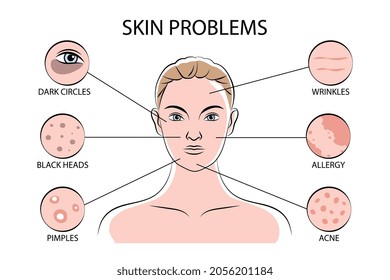 Infografik-Schema für Hausprobleme mit der Reparatur von Pimples schwarze Köpfe Falten Akne allergische dunkle Kreise Bereiche flache Vektorgrafik