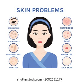 Skin problems. Isolated Asian Woman and Care, Treatment. Korean Girl has Acne, Black Dots, Wrinkles, Dark Circles, Dry and Oily Skin. Illustration for Beauty and Medical Design. Cartoon style. Vector