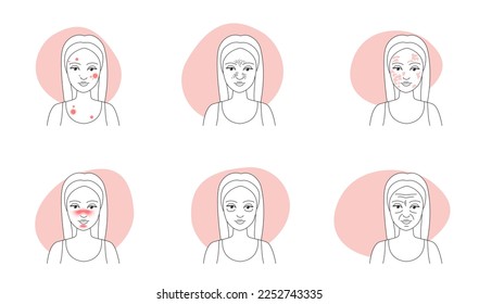 Skin problems line icons set vector illustration. Outline sketches of women with wrinkles and melasma, pimple infection and oily blackhead pore, rosacea on girls face in infographic collection