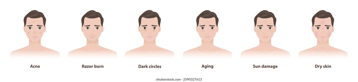 Skin problems in men vector illustration isolated on white background. Skin concerns men face, acne, pimple, razor burn, dark circles, aging, wrinkles, sun damage and dry skin. Men skin care concept.