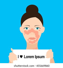 Skin problems Vector illustration Girl suffering from vitiligo holds a sign in his hands