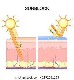 skin protection before and after Sunscreen. sunblock. sun cream. UV rays penetration into the layers of the human skin. UVB blocked by the epidermis. UVA rays damaging collagen fibers. vector diagram