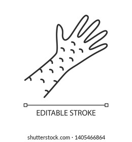 Skin rash, contact dermatitis linear icon. Irritation thin line illustration. Rubeola, measles symptom.   Hives, eczema, psoriasis contour symbol. Vector isolated outline drawing. Editable stroke