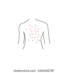Symbolvektor für Hautausschlag. Vektor-Illustration Allergie, Krätze, Windpocken, Röteln Ausschlag.