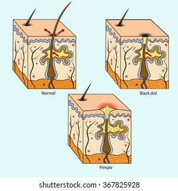skin rashes black dot