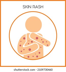 Skin Rashes Vector Icon. Skin Disease Illustration. Itching Rashes on Skin. Chicken Pox Vector. Measles Icon.