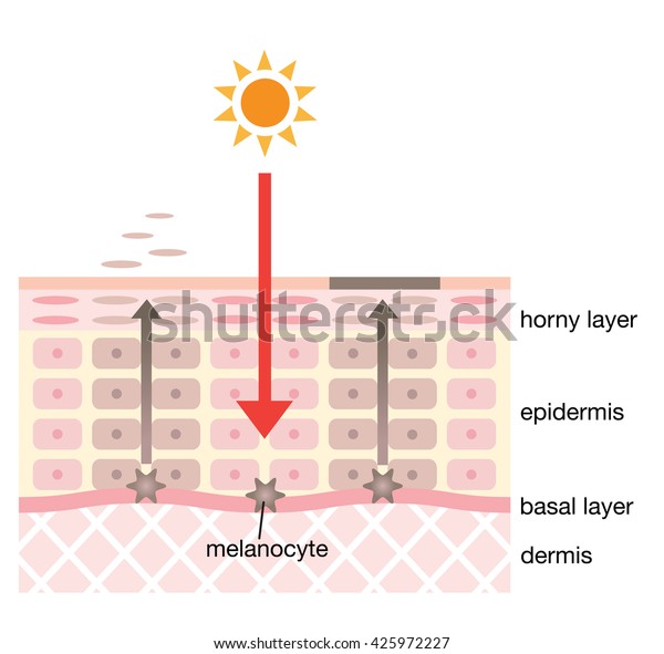 Skin Spot Mechanism Stock Vector (Royalty Free) 425972227 | Shutterstock