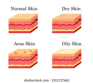 Skin types icons set. Vector stock illustration