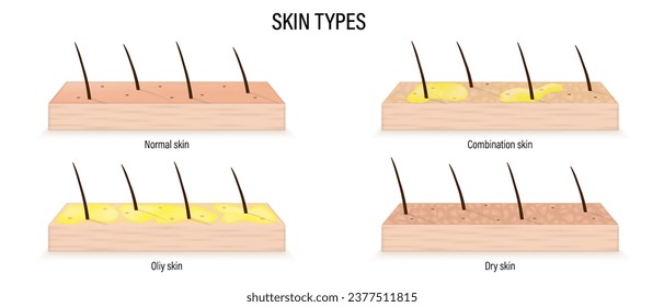 Tipos de piel vectoriales. Diferentes tipos de problemas cutáneos. Normal, combinación, oliy y piel seca.