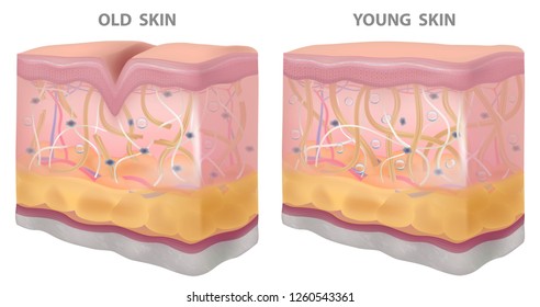 Skin young old wrinkles, dryness, realistic drawing,structure vector illustration
