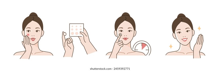 Skincare illustrations set. Collection of girl with problem skin applying pimple patch or absorbing pad on her face. Skin care routine and acne treatment concept. Vector illustration 