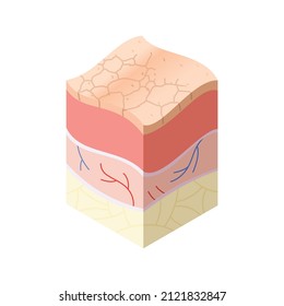 Skincare medical concept. Problems in cross-section of human skin horizontal layers structure. Anatomy illustrative model