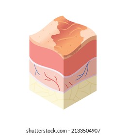 Skincare medical concept. Problems in cross-section of human skin horizontal layers structure. Anatomy illustrative model