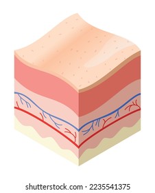 Skincare medical concept. Problems in cross-section of human skin horizontal layers structure. Anatomy illustrative model healthly layers of skin