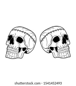 
skull head with a sewing wound on the forehead