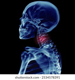 Skull and spine injury x-ray film on a dark blue background, side view