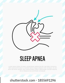 Sleep apnea, cause of insomnia. Respiratory problem. Thin line icon. Vector illustration.