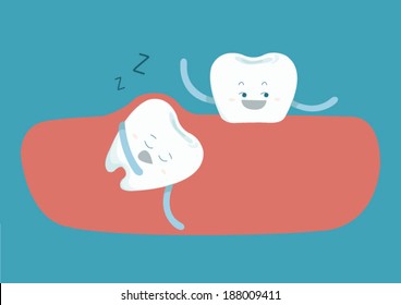 Sleepy tooth of impacted tooth