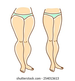 Slender and full of female legs