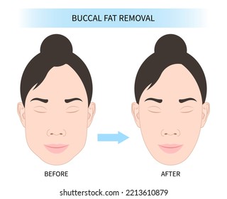 forma facial femenina con cuidado de la piel de belleza