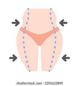 Diseño plano de liposucción delgado. Cirugía estética en el cuerpo femenino con líneas punteadas. Para clínicas de cirugía plástica, publicaciones médicas y de belleza. Ilustración vectorial.