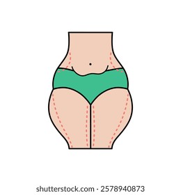 Slim liposuction flat design. Cosmetic surgery on women body with dotted lines. For plastic surgery clinic, medical and beauty publications