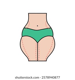 Slim liposuction flat design. Cosmetic surgery on women body with dotted lines. For plastic surgery clinic, medical and beauty publications