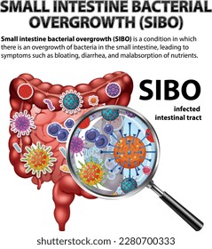 Small Intestine Bacterial Overgrowth (SIBO) illustration