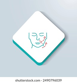 SMAS modification, or superficial musculoaponeurotic system modification, is a technique used in facial plastic surgery, particularly in facelift procedures