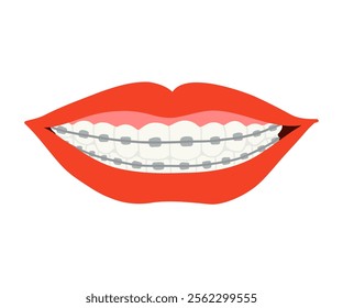 A smile with braces is drawn in a flat style. Healthy smile, braces, lips. Hand drawn vector illustration.